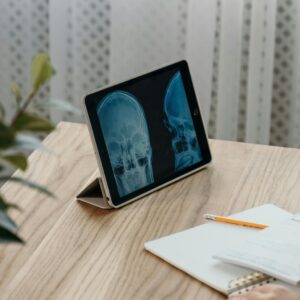 Tablet showing X-rays on wooden desk, pen and notebook nearby.