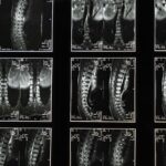 Comprehensive spinal x-ray images, ideal for medical studies and diagnostics.