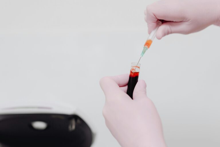 Lab technician using a syringe to handle a blood sample. Medical analysis concept.